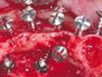 endodontics-general