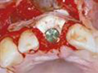 endodontics-miltidiscipline